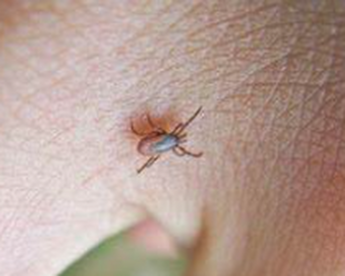Moeilijke diagnose Lyme vraagt om innovatieve oplossingen - Foto: Ingezonden foto
