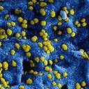 Rosengaerde neemt nieuwe maatregelen Coronavirus Rosengaerde neemt nieuwe maatregelen Coronavirus